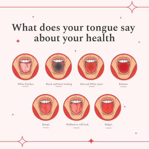 tongue health signs - navadiadentalclinic tongue health signs
tongue health issues
how to check health by tongue